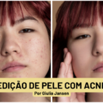 Eu vou retirar as acne/manchas da sua imagem mantendo natura...