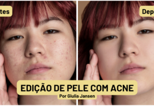 Eu vou retirar as acne/manchas da sua imagem mantendo natura...