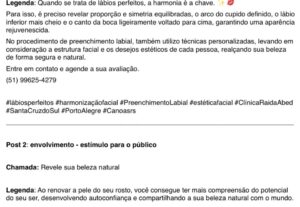 Eu vou criar textos para seu site, blog e redes sociais.