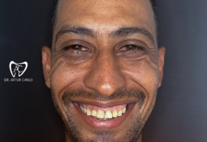 Eu vou fazer a arte do seu antes e depois