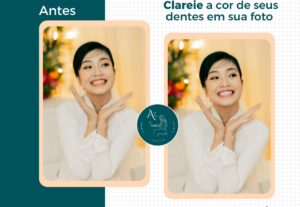 Eu vou deixar seus dentes brancos