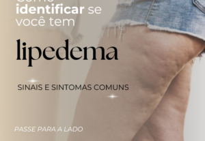 Eu vou criar posts para redes sociais