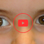 Eu vou fazer um video para você, tenho estrabismo