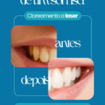 Eu vou criar 10 posts profissionais para o seu Instagram/Fac