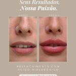 Eu vou fazer Designer /Marketing /Apresentações /Divulgação