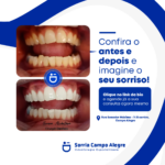 Eu vou criar artes profissionais para seu instagram