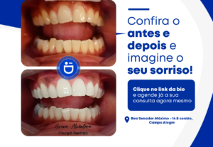 Eu vou criar artes profissionais para seu instagram