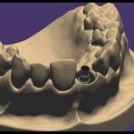 Eu vou fazer Instalação remota do Exocad 3.2 Elefsina