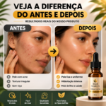 Eu vou fazer 5 criativos de antes e depois do seu produto