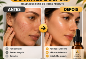 Eu vou fazer 5 criativos de antes e depois do seu produto